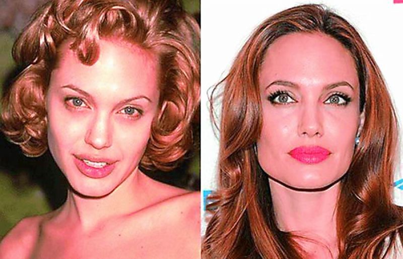 Angelina Jolie (before and after)