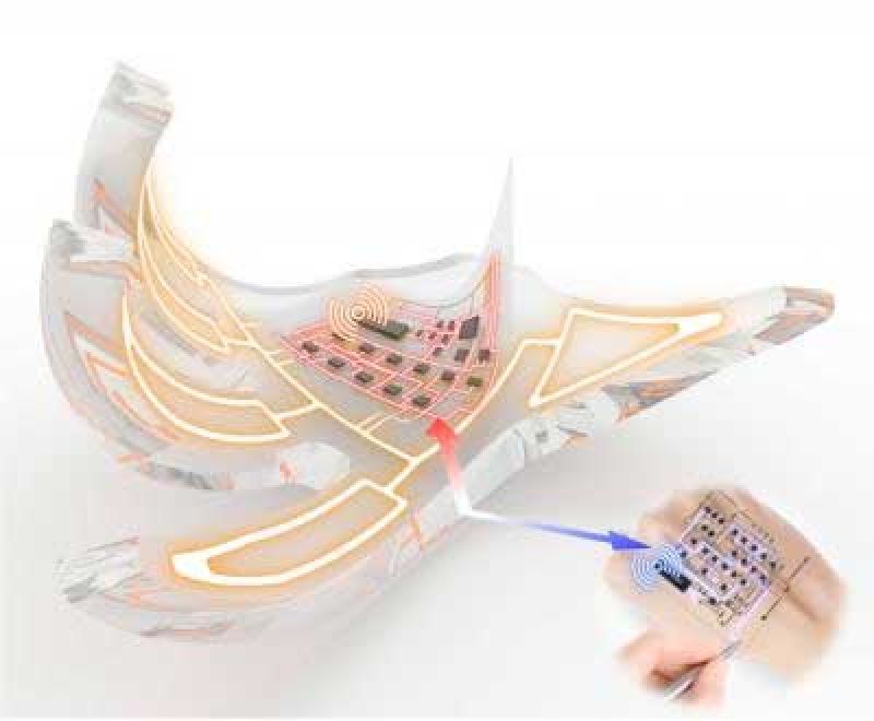 Skin-like electronic system