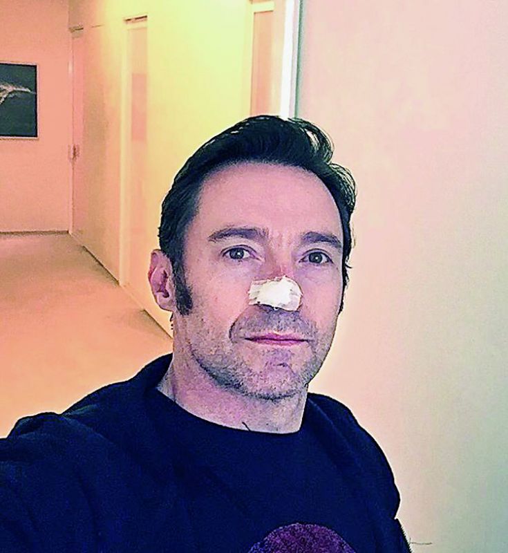 The photo that the actor posted online, after his surgery