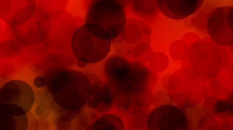 Young blood could help tackle Alzheimers disease. (Photo: Pixabay)