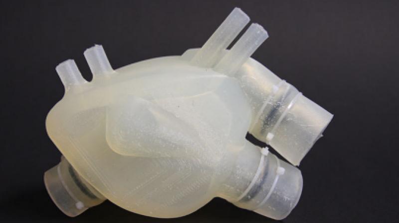 The artificial heart imitates a human heart as closely as possible. (Photo: Zurich Heart)