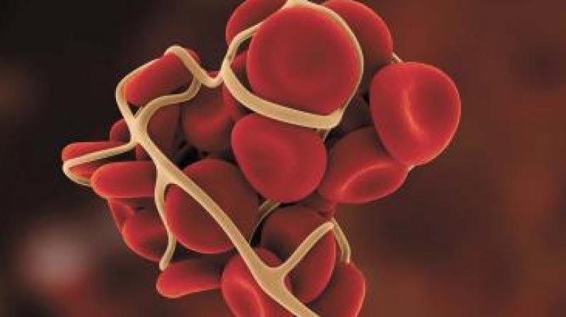 Presently, there are 1,000 patients in TS, who are registered with the Haemophilia Society of India. (Representational image)