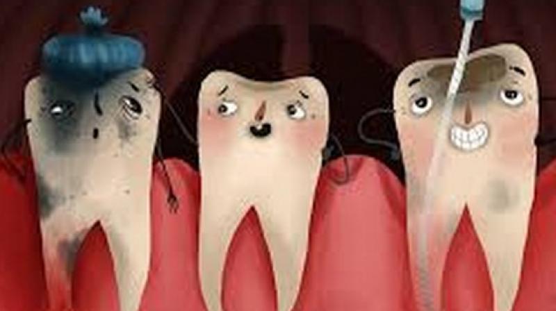 Root canal is not as bad compared to other dental procedures