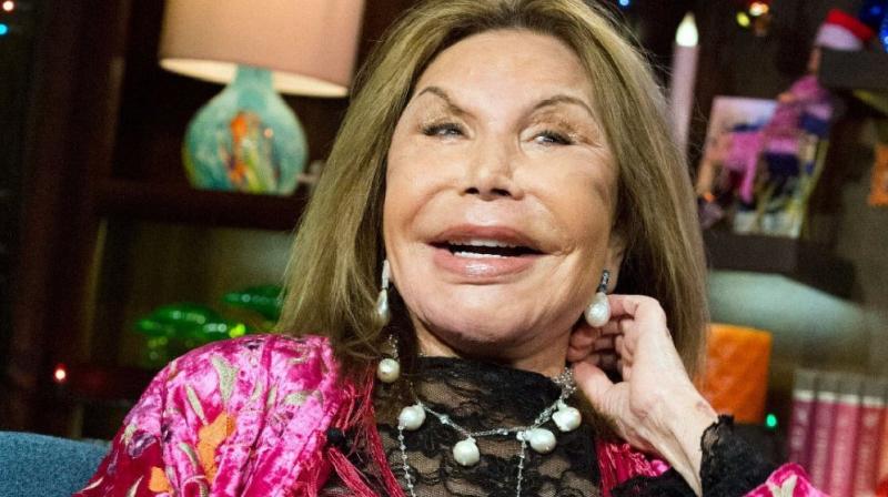\Real Housewives of Miami\ actor Elsa Patton passes away at 84