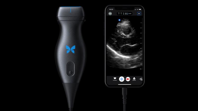 Butterfly iQ costs USD 2,000 and unlike the bulky traditional ultrasound machines, it carries the technology right in itself.
