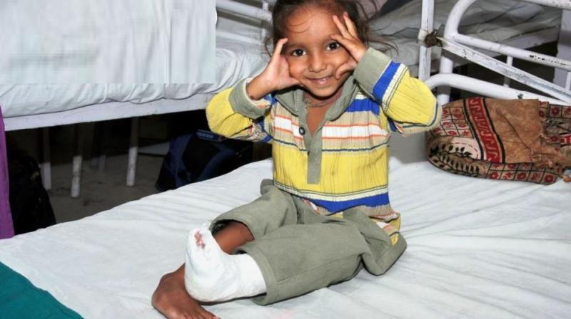 How clubfoot treatment can make your child walk again