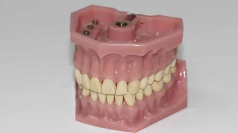 The long-term problems with ill-fitting dentures