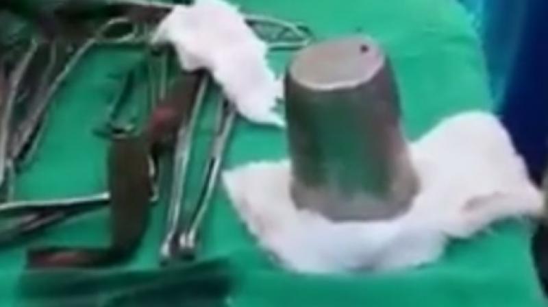 The cup was removed after operating for one and a half hours (Photo: YouTube)