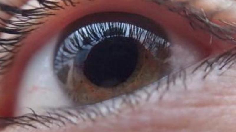 Hyderabad: LV Prasad Eye Institute creates special contact lenses
