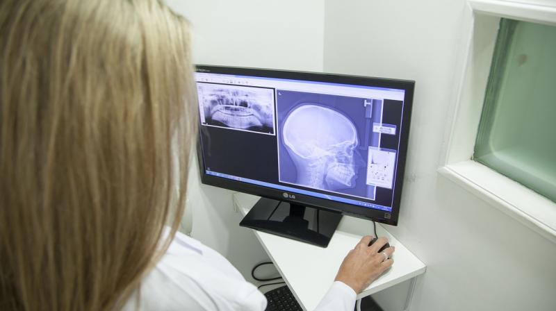 Commercialisation of this technology offers the potential for producing low-dose X-ray detectors that can scan the whole body at once. (Representative Image)