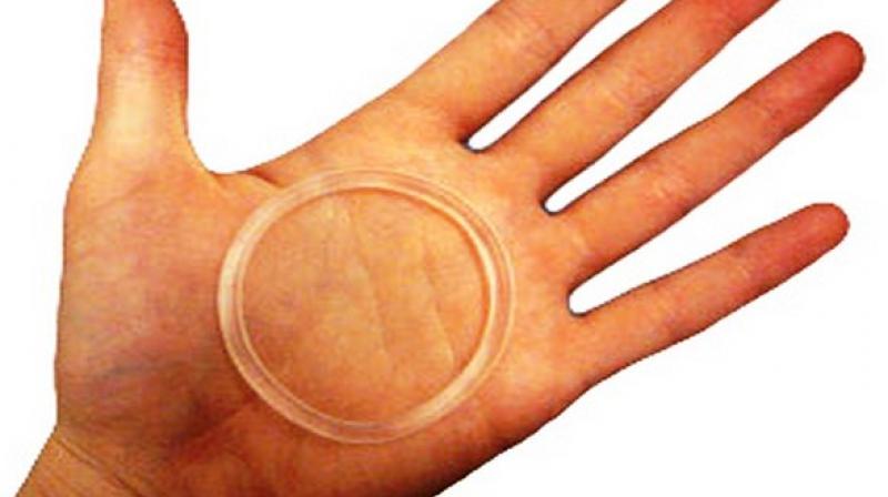 Vaginal ring to prevent unwanted pregnancy