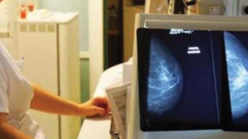 Over 3,000 X-ray units in state illegal, says DRS report