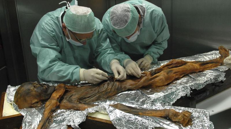 In this November 2010 photo provided by the South Tyrol Museum of Archaeology, researchers examine the body of a frozen hunter known as Oetzi the Iceman to sample his stomach contents in Bolzano, Italy. (Photo: AP)