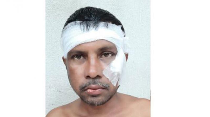 WB: TMC worker beaten for chanting \Jai Shri Ram\ in Basirhat