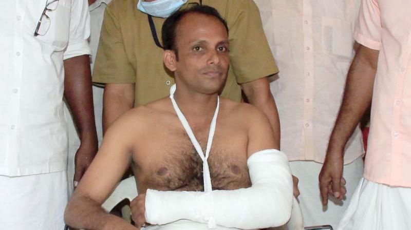 Injured MLA Eldho Abraham at Ernakulam general hospital