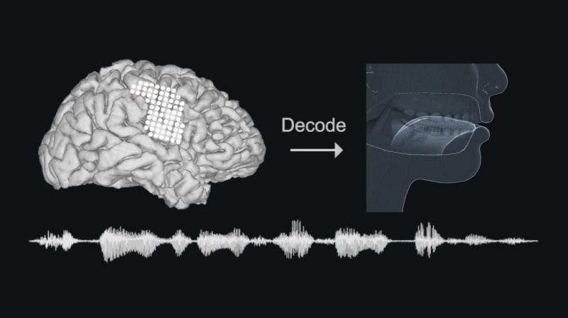 Scientists at the University of California, San Francisco, implanted electrodes into the brains of volunteers and decoded signals in cerebral speech centres to guide a computer-simulated version of their vocal tract - lips, jaw, tongue and larynx - to generate speech through a synthesizer.