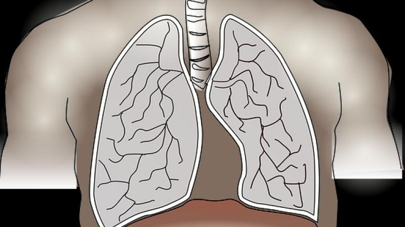 Lung disease second biggest killer in India