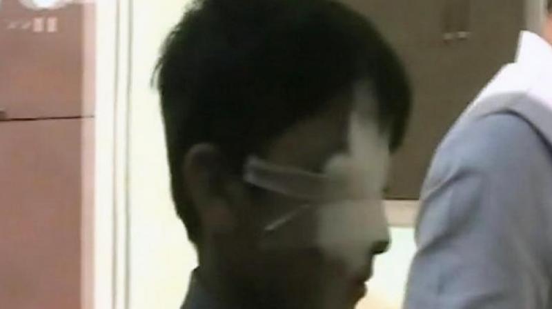 The family has also alleged that the moment the child was slapped, the membrane of his eyes burst and slowly he started losing sight. (Photo: ANI)(Photo: ANI | Twitter)