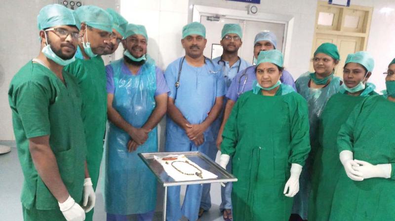 From left, the 99 gallstones removed from womans body in Tumakuru. A team of  surgeons at District Hospital Tumakuru who conducted the surgery. (Photo:DC)