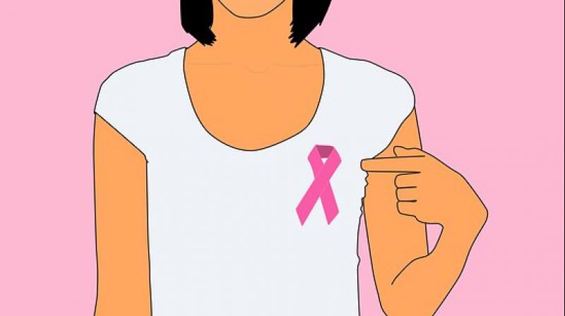 Its urgent to have a national breast cancer program in India, while at the local level, awareness needs to be raised about breast cancer. (Photo: Pixabay)