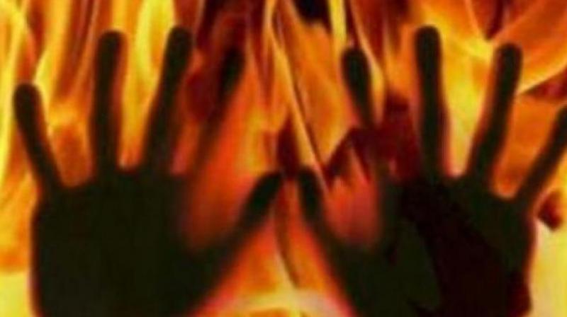 UP teenager succumbs after being set ablaze for not chanting \Jai Shri Ram\