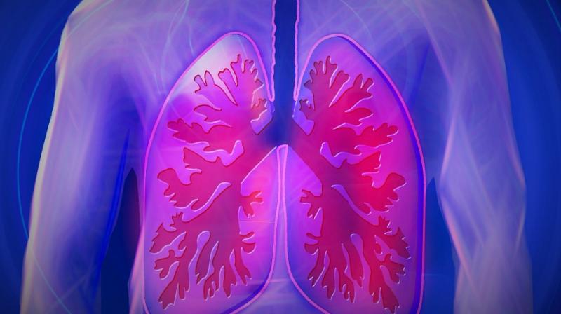 Chronic obstructive pulmonary disease (COPD) includes respiratory conditions that narrow the airways, such as bronchitis and emphysema. (Photo: Pixabay)