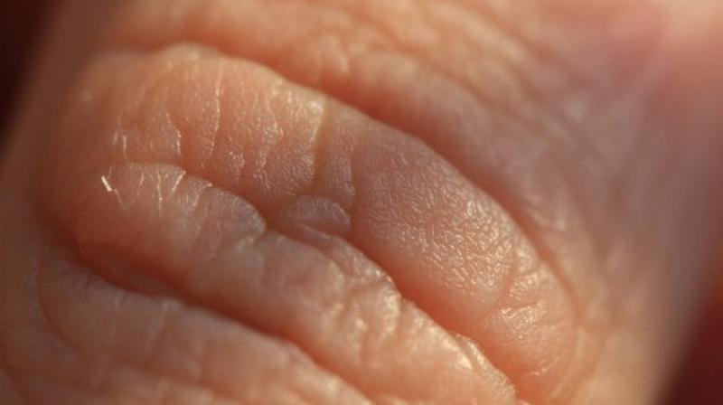 Researchers discover new pain organ in skin