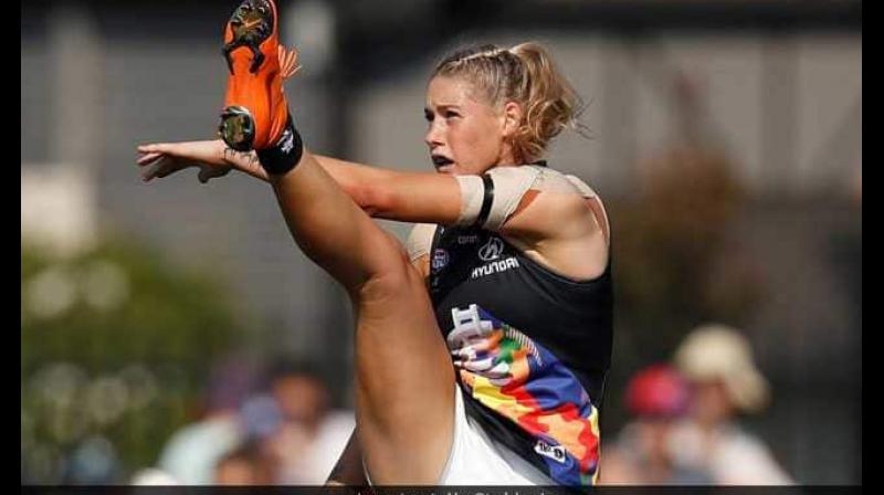 Harris, who plays for Carlton in the Australian Football League Womens (AFLW) competition, was pictured with her leg fully extended as she kicked a goal in a photograph posted online by a broadcaster on Tuesday. (Photo: Twitter)