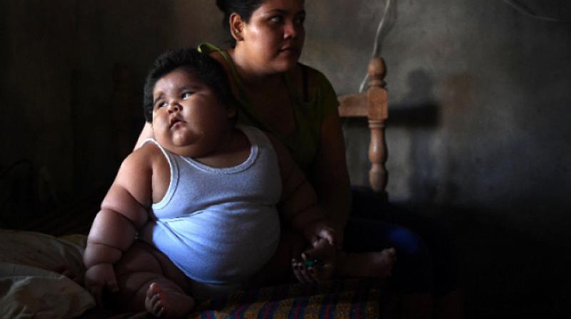 Mexico leads the world in childhood obesity and diabetes, and Gonzales is an extreme example of this unwelcome distinction. (Photo: AFP)