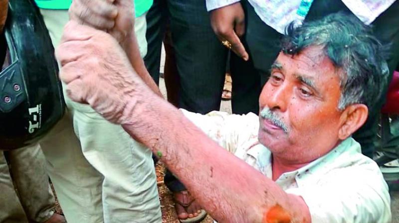Warangal: Man who fell into well rescued after two days