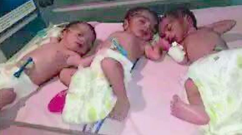 Jagtial: Woman gives birth to triplets