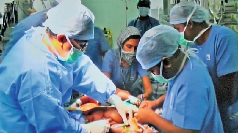 Rare angioplasty performed for first time in the Kerala