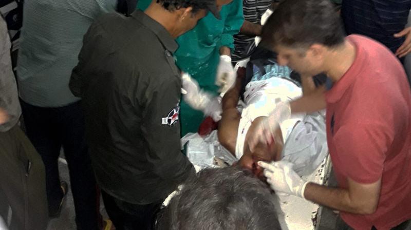 Injured being treated in a hospital after militants opened fire on the Amarnath Yatra in which some pilgrims were killed many injured in Anantnag in Jammu and Kashmir. (Photo: PTI)