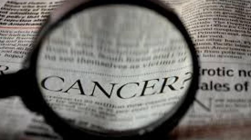 Dr Sai Ram, senior clinical oncologist at MNJ cancer hospital explained,  When a patient comes with Stage 3 and Stage 4 cancer, the treatment is aggressive. (Photo: Pixabay)
