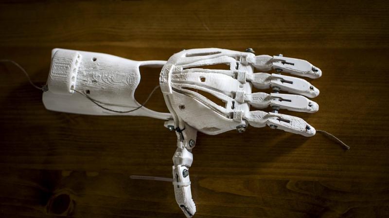 The mother and son teamed up to build a 3D-hand for him and now the child has learnt to print and build similar limbs (Photo: Pixabay)