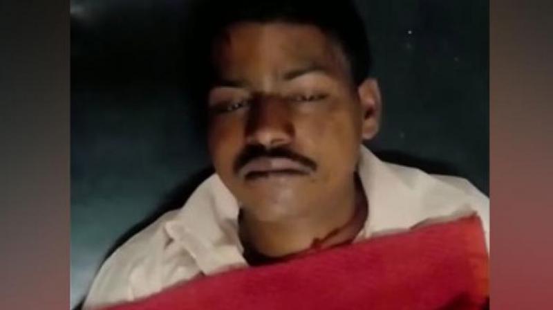 The victim working in Betul, a place situated within 178 kilometre from the capital of Bhopal, was identified as Manish and is currently under medical care. (Photo: Twitter | ANI)