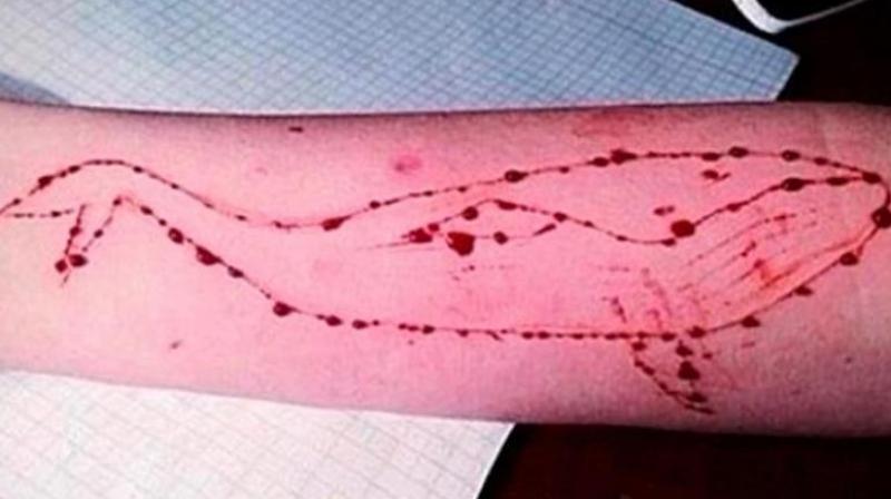 Police said that the online game, which originated in Russia, starts by asking participants via social media to draw a blue whale on a piece of paper and then to carve it on their bodies. (Photo: Twitter)