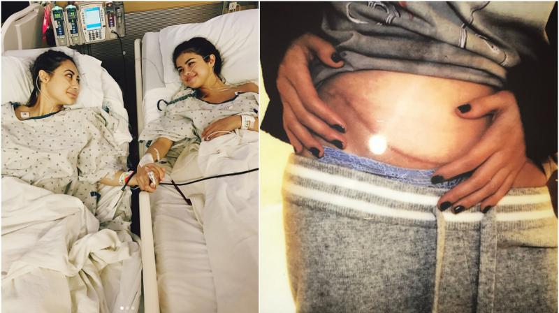 Selena Gomez undergoes kidney transplant, best friend was donor