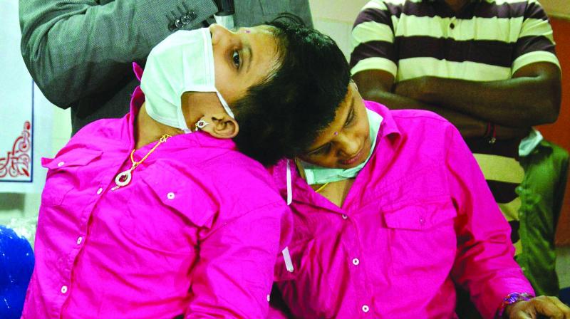 Conjoined twins Veena and Vani will not be shifted from Niloufer Hospital to the state home as the government is waiting for medical reports from doctors in Australia who are looking at the option of separating the twins.