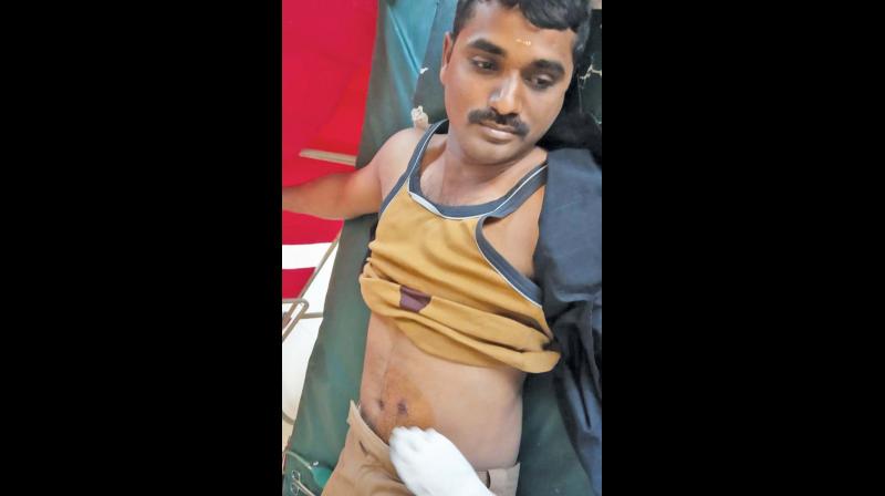 Erode: Jawan hurt as gun goes off by accident