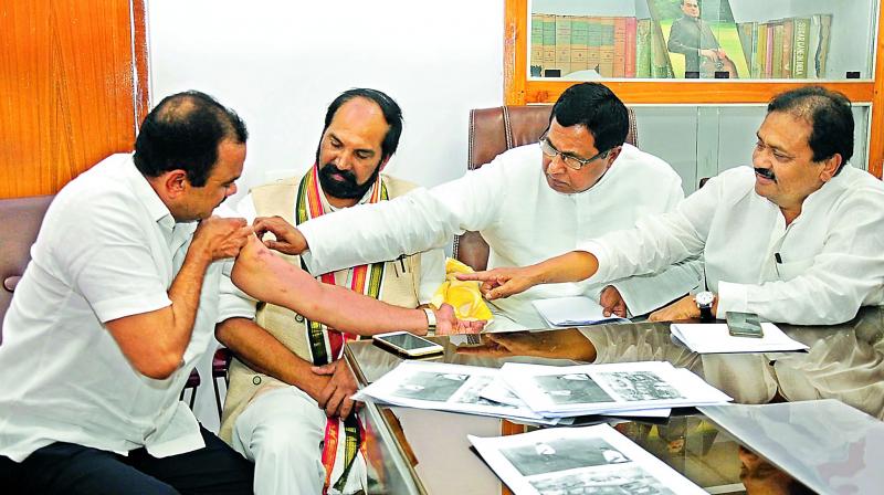 Congress senior leaders N. Uttam Kumar Reddy, K. Jana Reddy and Mohd. Ali Shabbir examine the injuries on MLA Komatireddy Venkata Reddys arm.