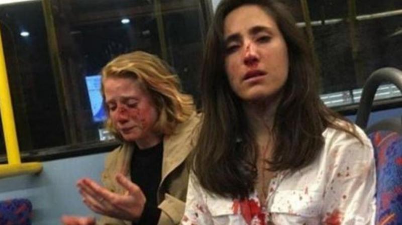 Asked us to kiss so they could enjoy watching: Lesbian couple assaulted on London bus
