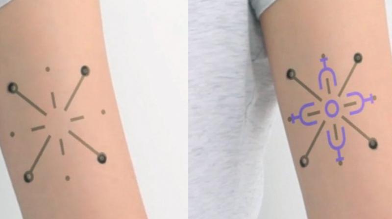 Now colour-changing tattoos that can track diabetes, kidney disease