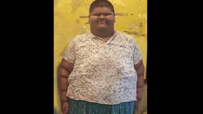 Mihir weighed 2.5 kg at birth in 2003. He first showed signs of obesity at the age of 5, weighing 60-70 kg, the hospital said. Mihirs family has a history of obesity, but the boy also had an uncontrolled diet and would consume a lot of junk food. (Photo: Facebook screengrab)