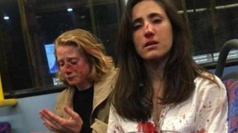 UK police bail 5 teens arrested over bus attack on lesbian couple in London
