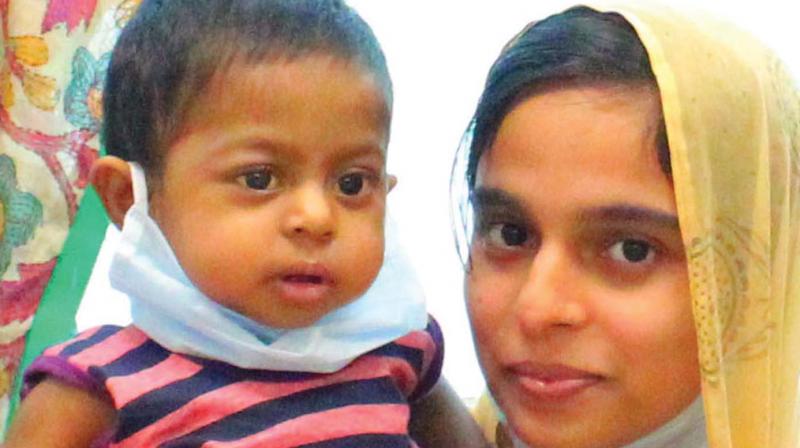 Kochi: 13-month old gets liver transplant