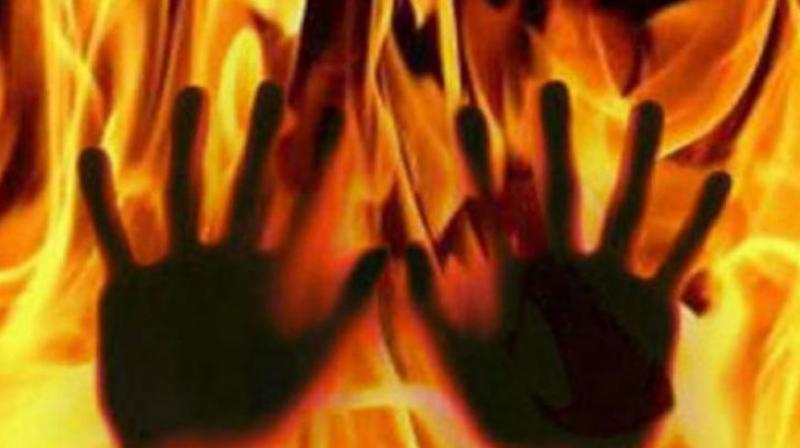 Kakinada: Youth suffers burns in birthday mishap