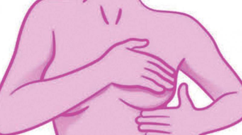 Breast Cancer: Early detection is the need of the hour