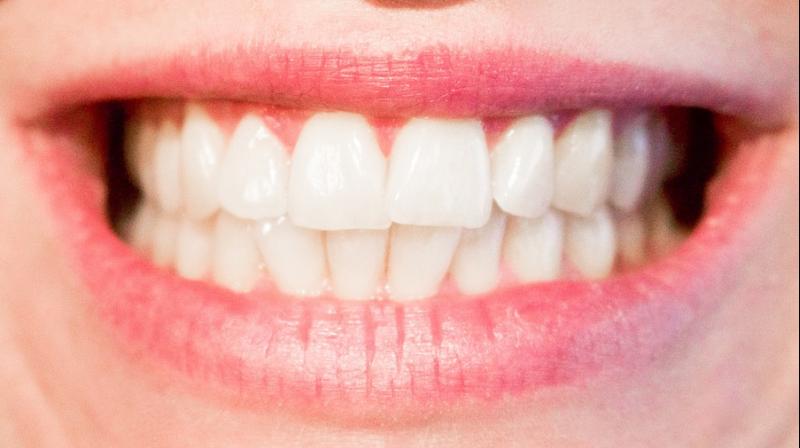Poor oral health ups frailty risk in older men. (Photo: Pixabay)