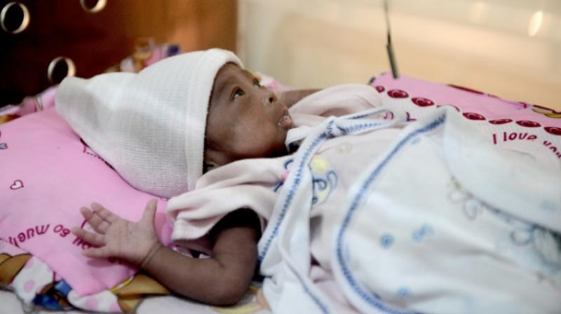 Weighing less than 2.5 kilos at birth is closely linked to high rates of neonatal mortality and ill health later in life. (Photo: AFP)